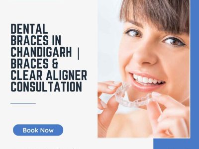 Dental Braces in Chandigarh | Braces & Clear Aligner Consultation
