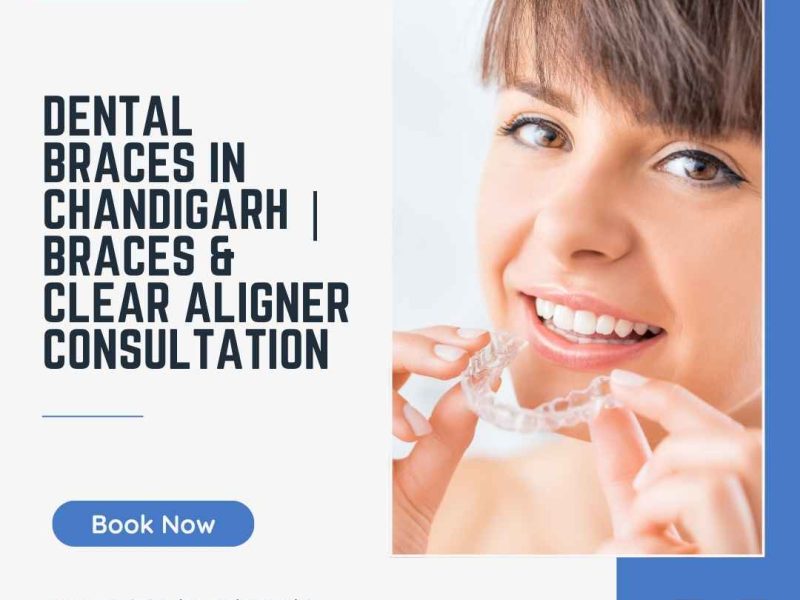 Dental Braces in Chandigarh | Braces & Clear Aligner Consultation