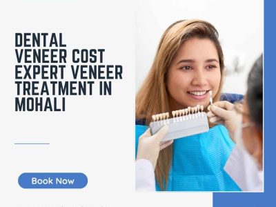 Dental Veneer Cost | Expert Veneer Treatment in Mohali