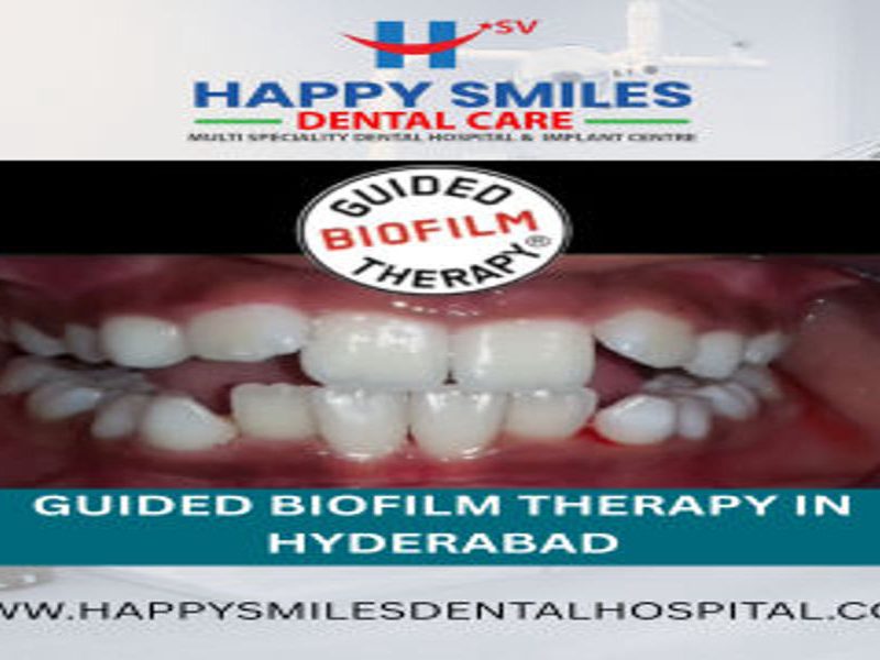 Affordable Guided Biofilm Therapy Cost in Hyderabad | Advanced Dental Cleaning Solutions