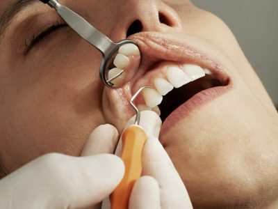 Affordable Dentist Near Me | Low-Cost Dental Clinic in Gorakhpur