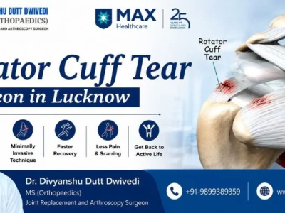 Arthroscopic Rotator Cuff Surgery in Lucknow