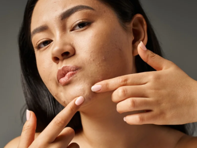 Transform Your Skin with the Best Dermatologist in Nagpur