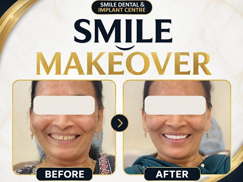 Get Your Dream Smile! Custom Smile Makeovers at Smile Dental & Implant Centre