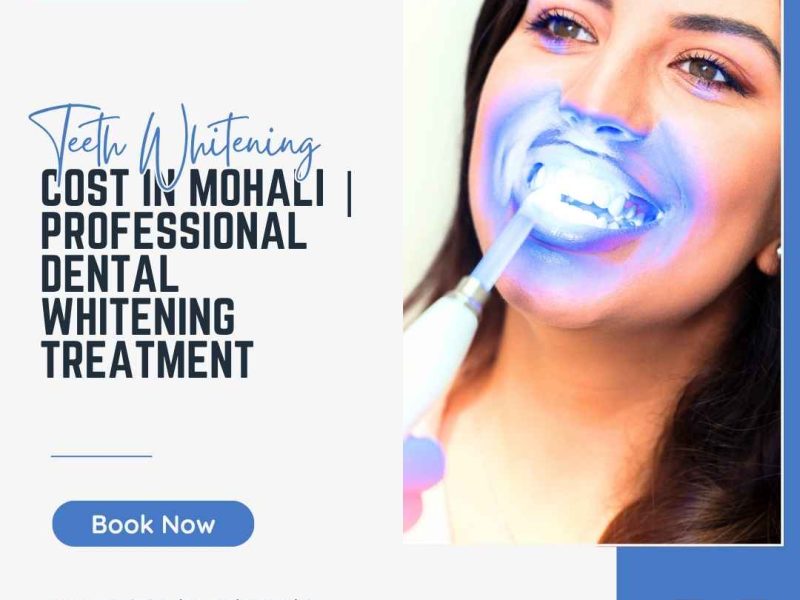 Teeth Whitening Cost in Mohali | Professional Dental Whitening Treatment