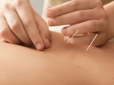 Pain Management Acupuncture in NYC | Back, Neck & Sciatica Relief