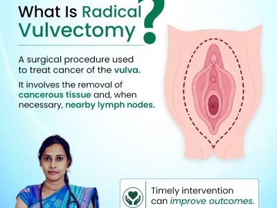 Best Gynaecologist & Gynaecologic Oncologist in hyderabad