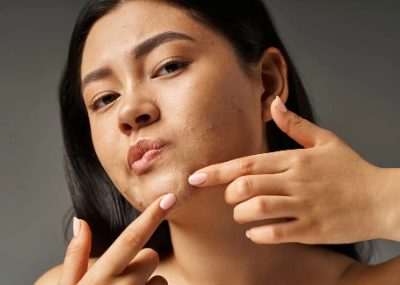 Safe and Effective Skin Lesion Removal in Nagpur