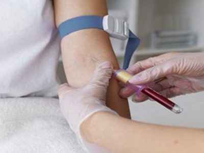 Book a Prolactin Test at an Affordable Price from Max Lab