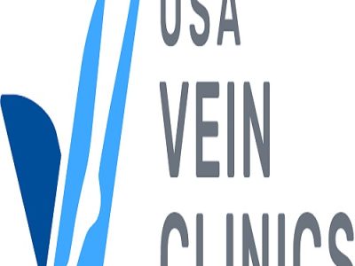 Advanced Vein Doctor Queens Using Modern Treatment Options