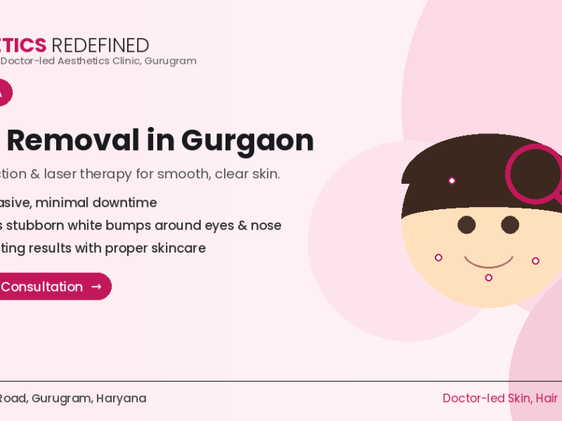 Milia Removal Treatment in Gurgaon | Aesthetics Redefined
