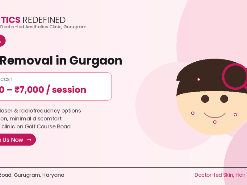 Milia Removal Treatment in Gurgaon | Aesthetics Redefined