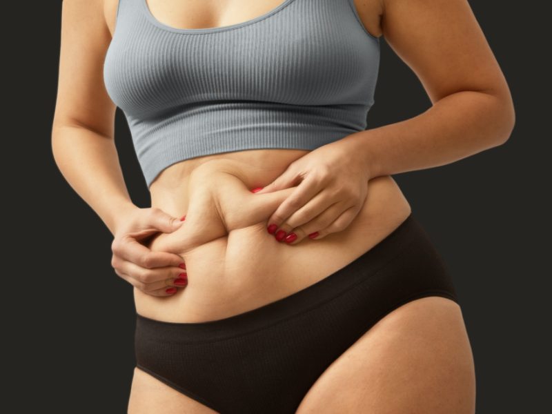 Liposuction in Andheri | Expert Body Contouring