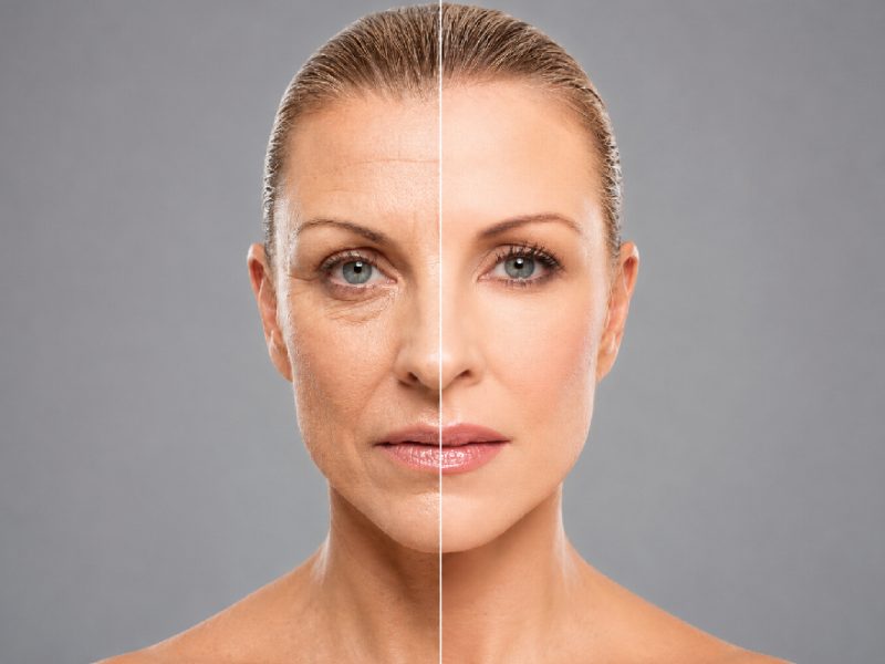 Best Face Rejuvenation Surgery in Mumbai by Expert Plastic Surgeons