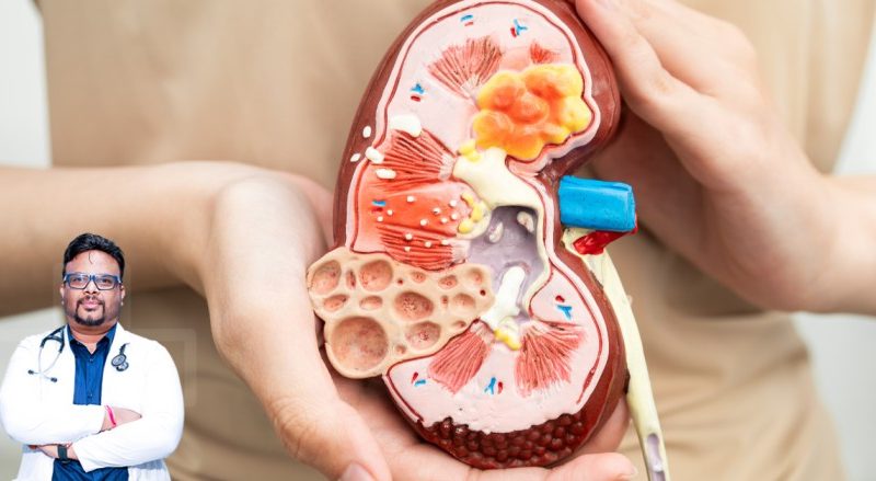 Visit Kidney stone hospital in siliguri for Comprehensive Stone Management