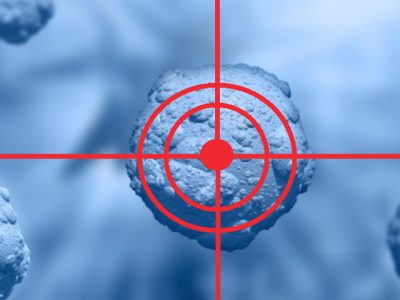 Targeted Therapy Treatment in Noida | Dr. Manish Singhal Care