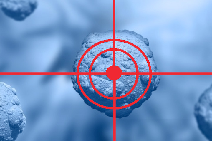 Targeted Therapy Treatment in Noida | Dr. Manish Singhal Care