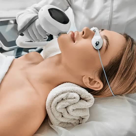 Laser IPL Skin Treatments Melbourne for Radiant Looking Skin