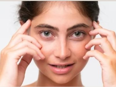 Under Eye Dark Circles Treatment Near DLF Phase Area, Gurgaon