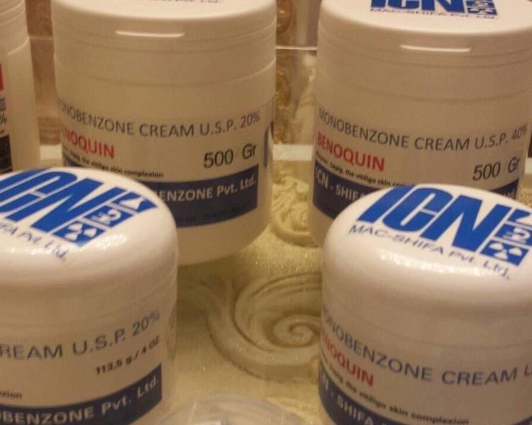 ICN – 80% monobenzone benoquin creams for sale.