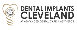 Restore Your Smile with Advanced Dental Implants For Missing Teeth Cleveland