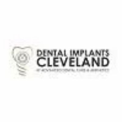 Dental Implants Cleveland