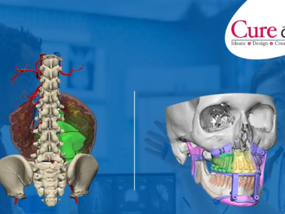 Digital Surgery Planning for Patient-Specific Procedures