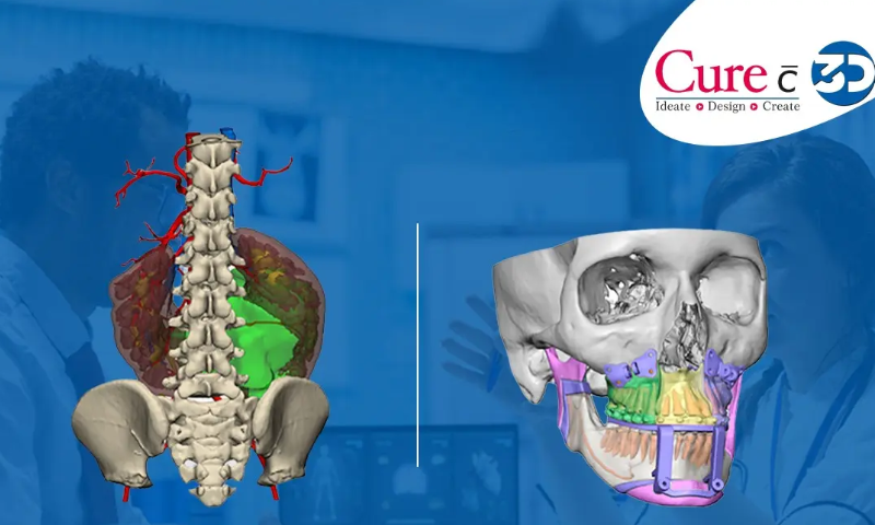 Digital Surgery Planning for Patient-Specific Procedures