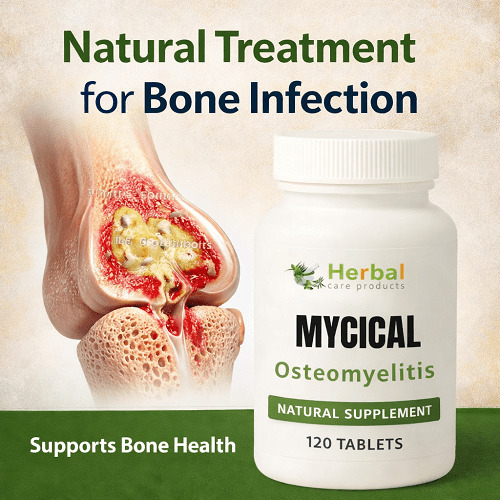 Best Herbal Supplements for Osteomyelitis: What to Consider Before Buying