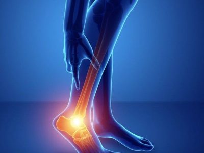 Stem Cell Therapy for Ankle Ligament Injury in Mumbai | RegenOrthoSport