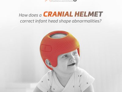 long head shape in babies: How Long Does It Take to Change?