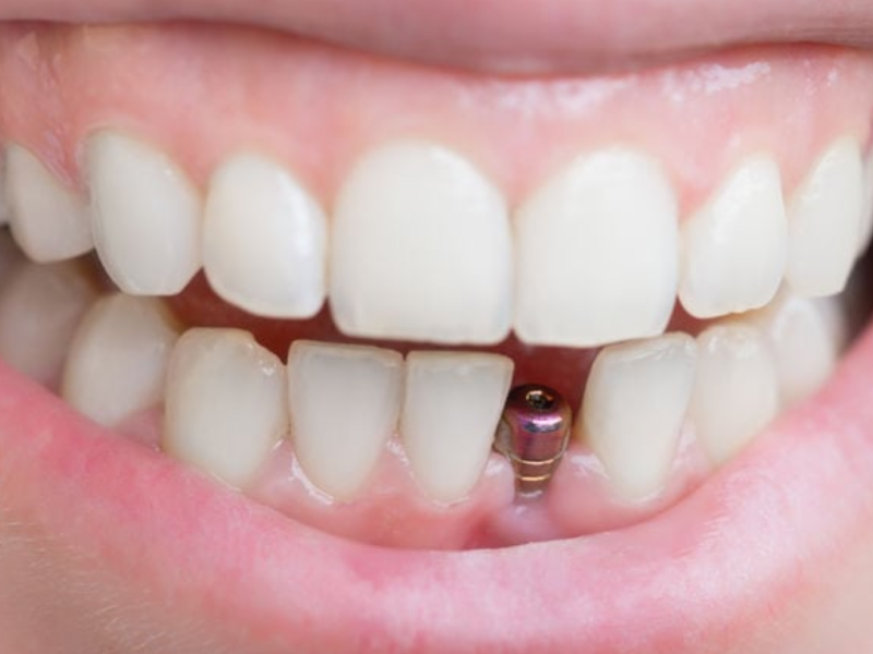 Trusted Dental Care in Orange California