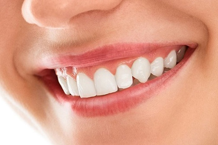 Dental Smile Makeover in Indore Dr Atul Jajoo