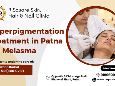 Hyperpigmentation Treatment in Patna for Melasma at R Square