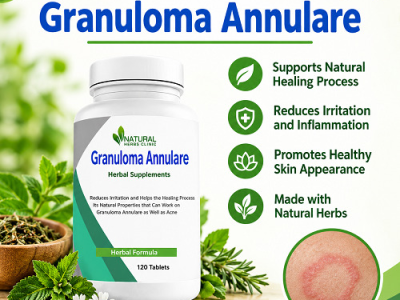 Best Supplements for Granuloma Annulare