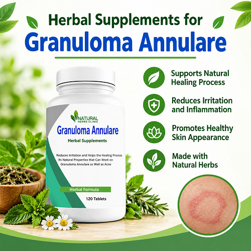 Best Supplements for Granuloma Annulare