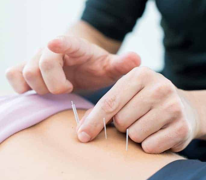 Acupuncture Indianapolis | Relief for Neck, Back and Headache Pain