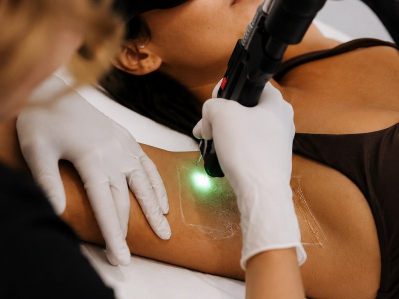 Laser Hair Removal in Toronto | Smoother Skin, Less Shaving